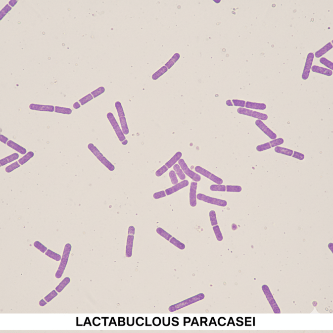 Lactobacillus Paracasei